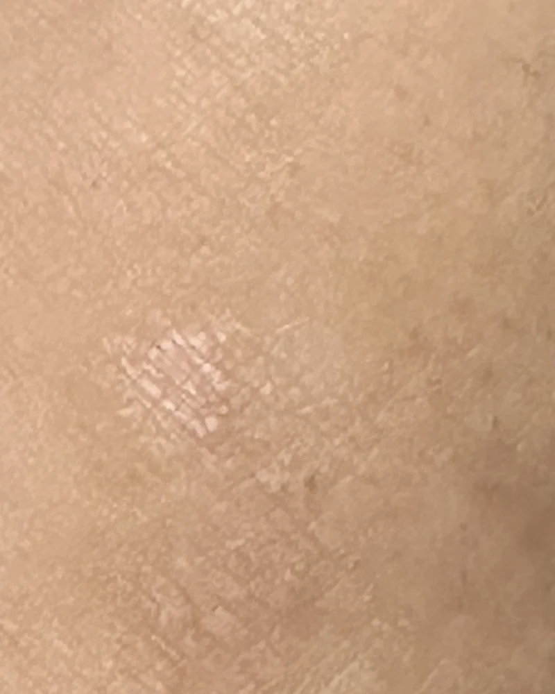 2026 年 8 月 29 日同一部位在不同光線下的皮膚特寫